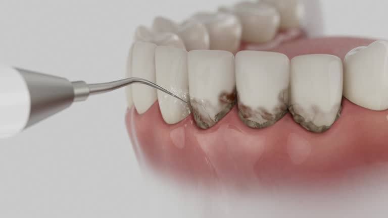 Reliable Root Canal Treatment contractor in Alamance County County, NC by Dentist Open Now